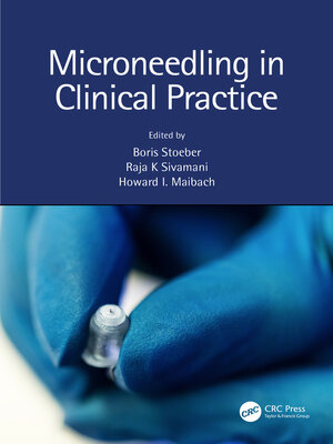 cover image of Microneedling in Clinical Practice